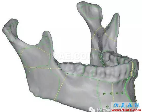 Hypermesh 2015 CAE 有限元網(wǎng)格競賽作品案例hypermesh分析圖片10